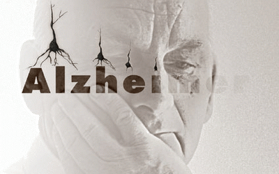 Taller de Enfermos Alzheimer